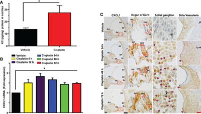 Targeting CXCL1 chemokine signaling for treating cisplatin ototoxicity